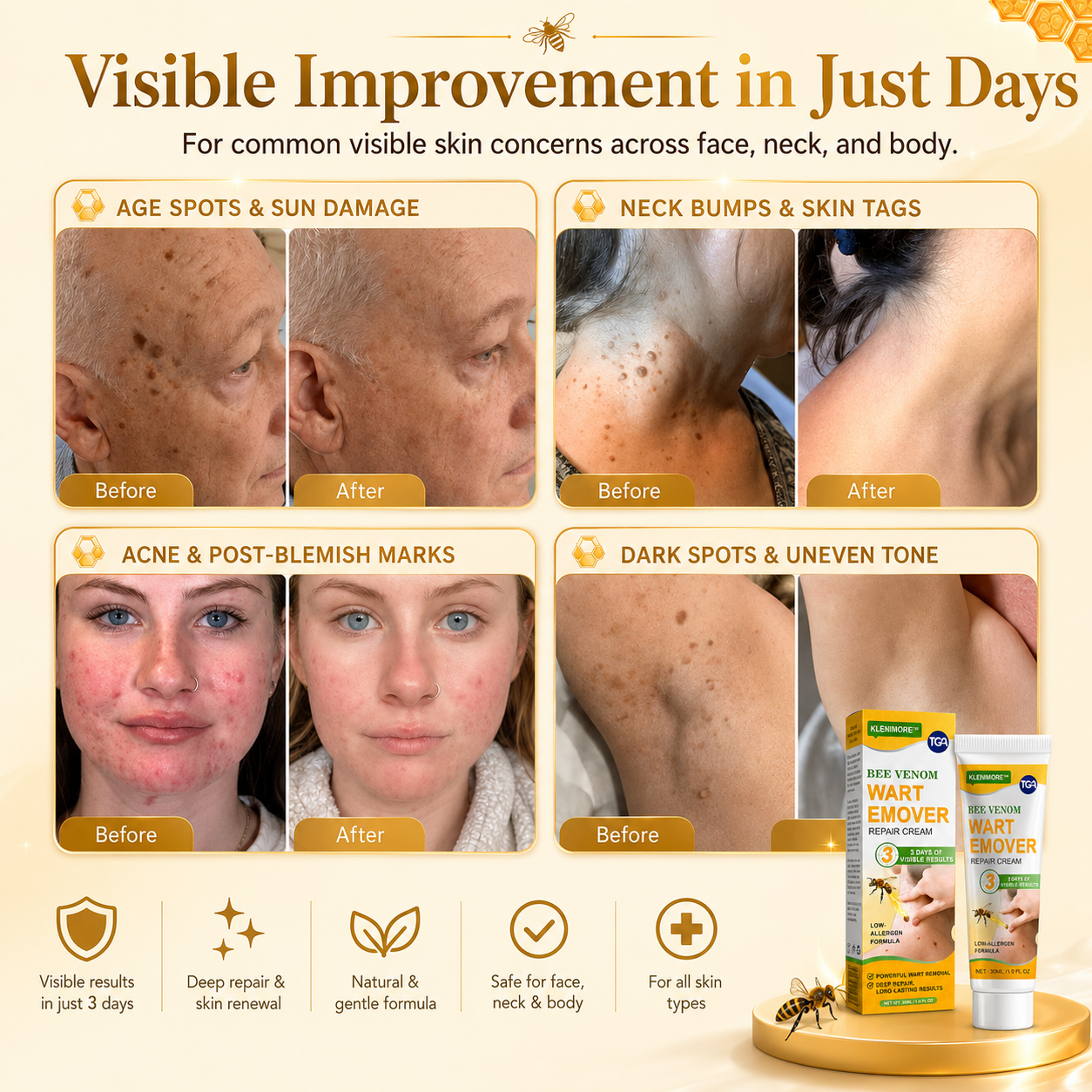 Fade Warts, Smooth Texture, Even Tone — One Cream For Complete Wart Removal & Skin Recovery