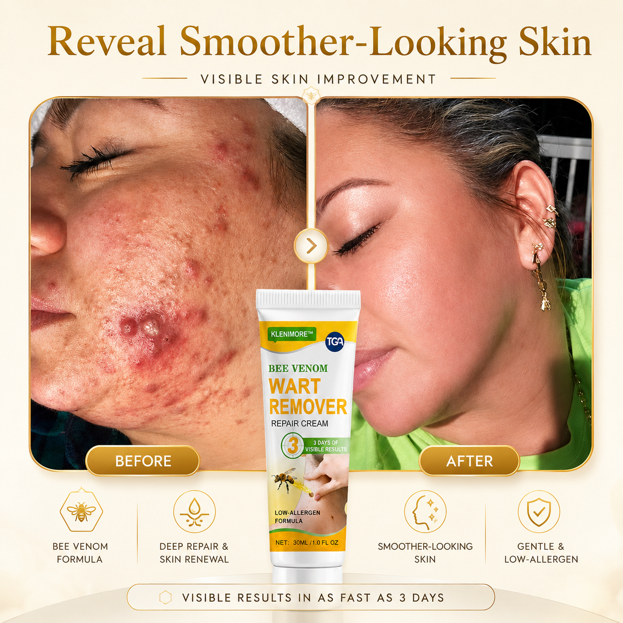 Fade Warts, Smooth Texture, Even Tone — One Cream For Complete Wart Removal & Skin Recovery