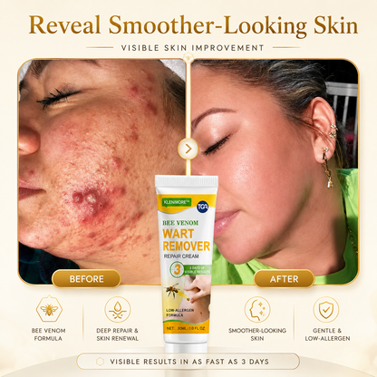 Fade Warts, Smooth Texture, Even Tone — One Cream For Complete Wart Removal & Skin Recovery