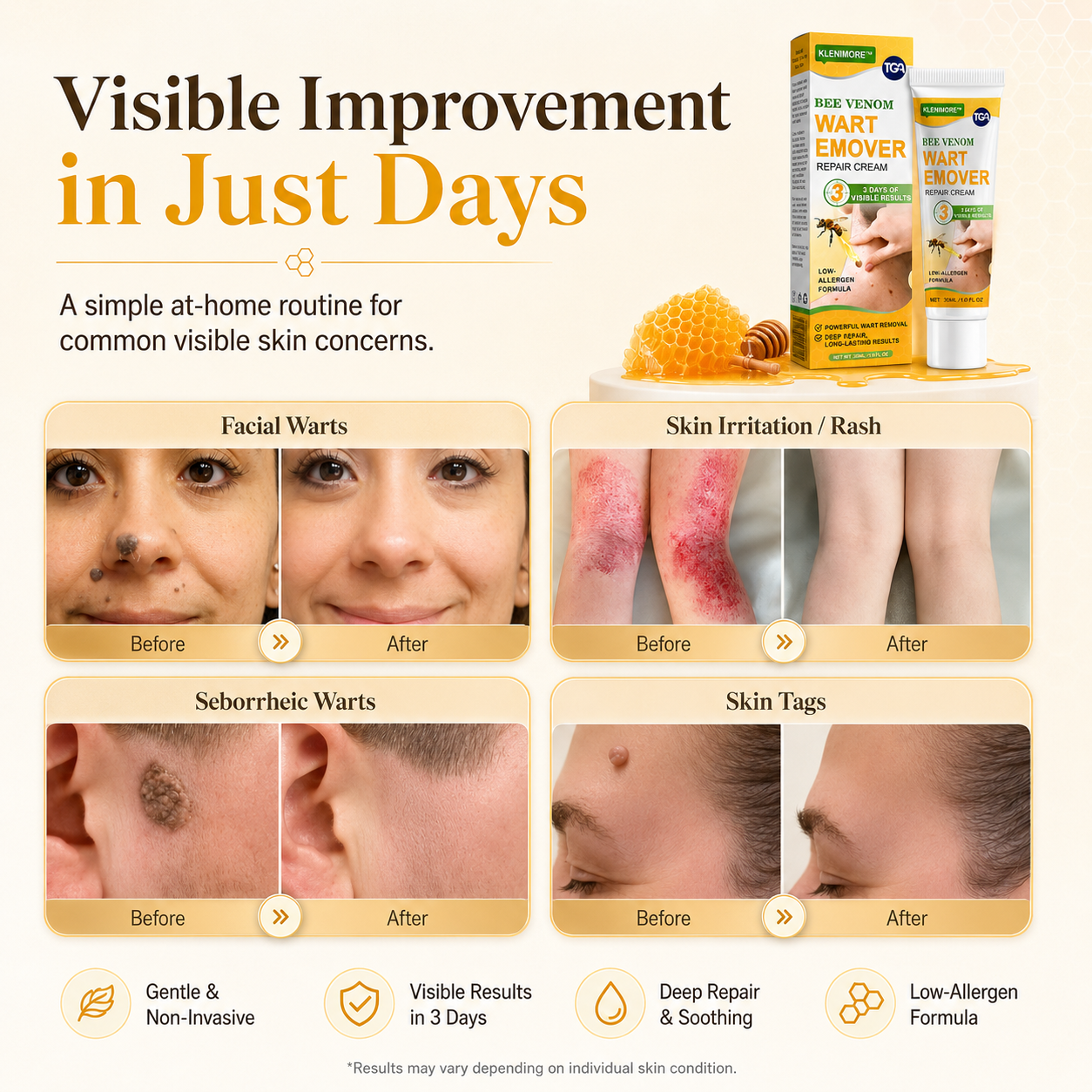 Fade Warts, Smooth Texture, Even Tone — One Cream For Complete Wart Removal & Skin Recovery