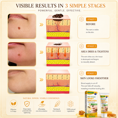 Fade Warts, Smooth Texture, Even Tone — One Cream For Complete Wart Removal & Skin Recovery